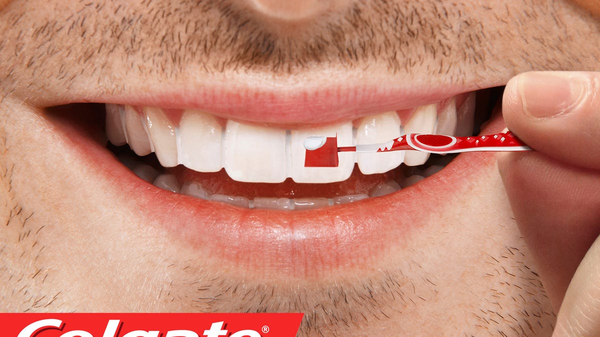 Colgate Unveils New Dental Grout To Fill In Gaps Between Teeth