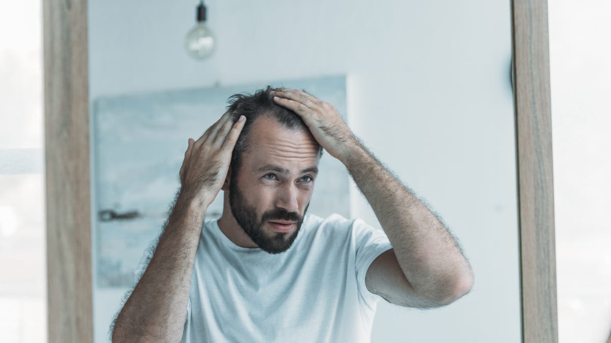 How Check If Your Hair Loss Is Within Normal Limits