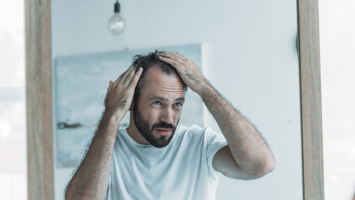 Does Shampoo Cause Hair Loss  SkinKraft