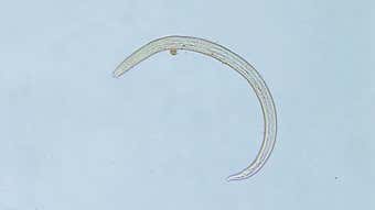 Image for An Invasive Brain-Infecting Worm Has Made Its Way to Georgia