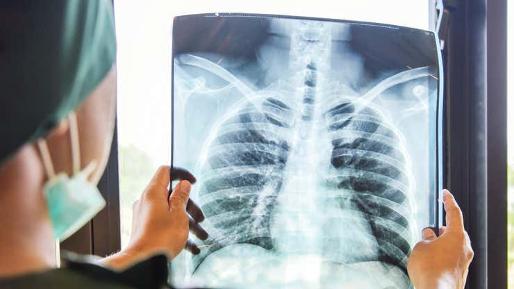 Image for Tuberculosis-Infected Woman Still Going Out in Public Despite Arrest Warrant