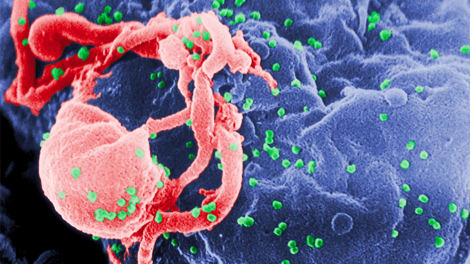 HIV-1 attached to a white blood cell.