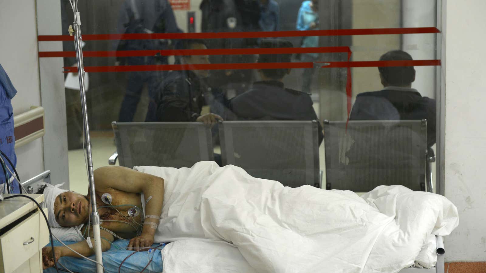 A man injured in an attack on a Chinese train station rests in a hospital in Kunming.