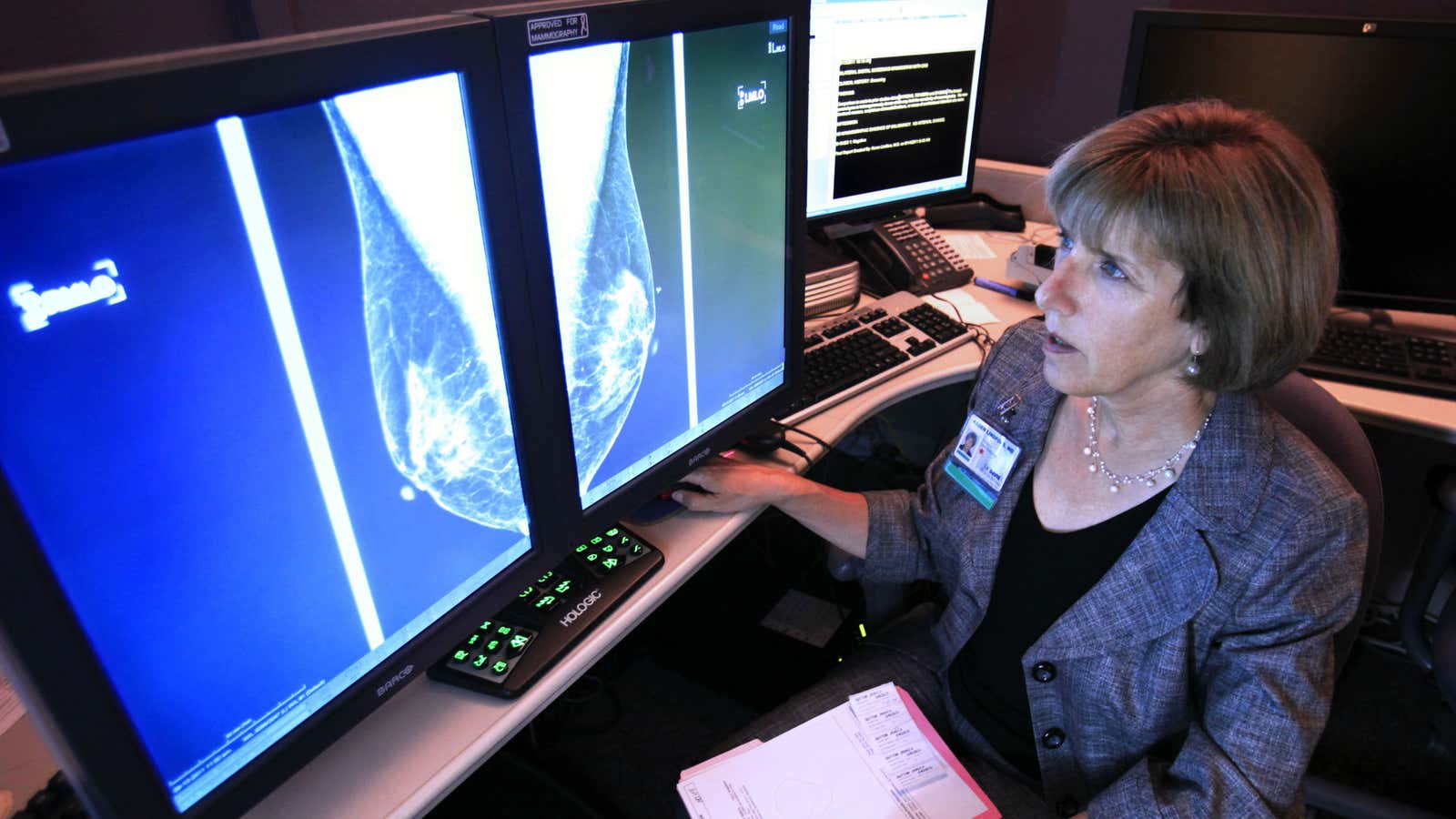 Mammograms are still the way to go.