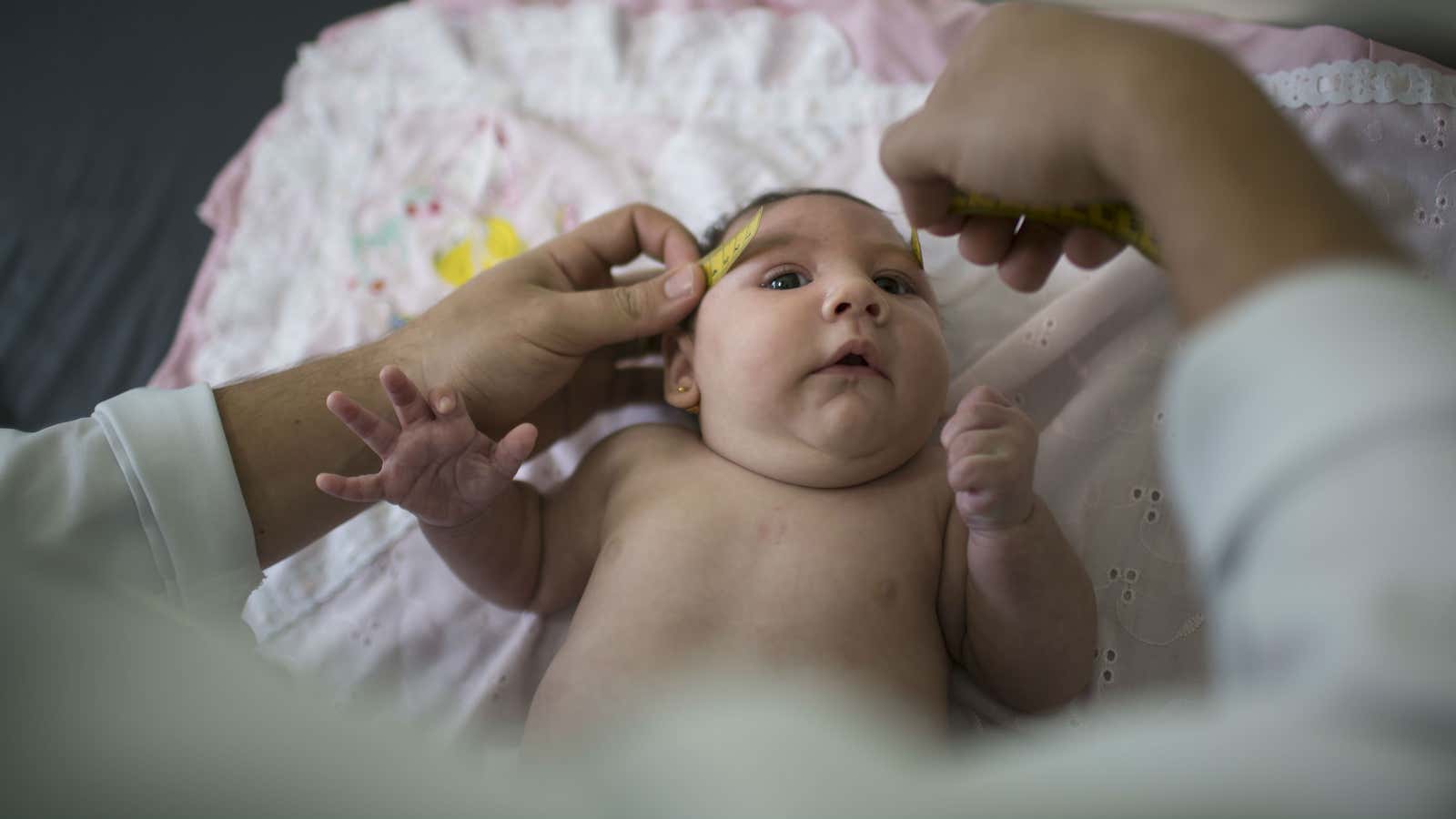 A baby in Brazil has her head measured by a neurologist.