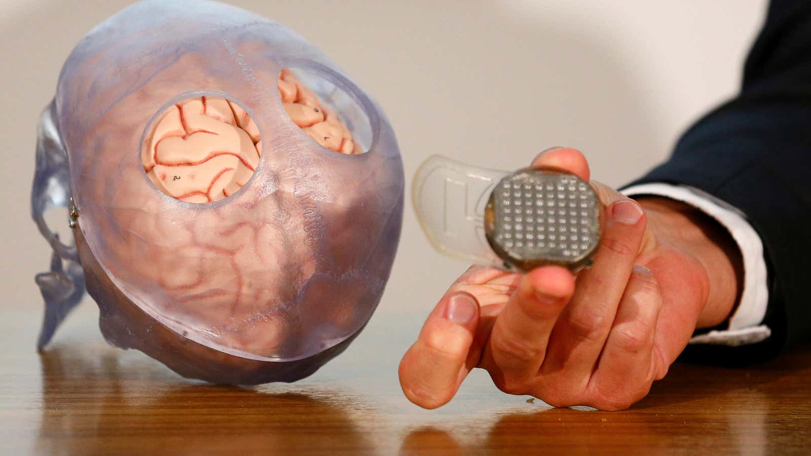 Neural implants are used for deep brain stimulation, vagus nerve stimulation, and mind-controlled prostheses.