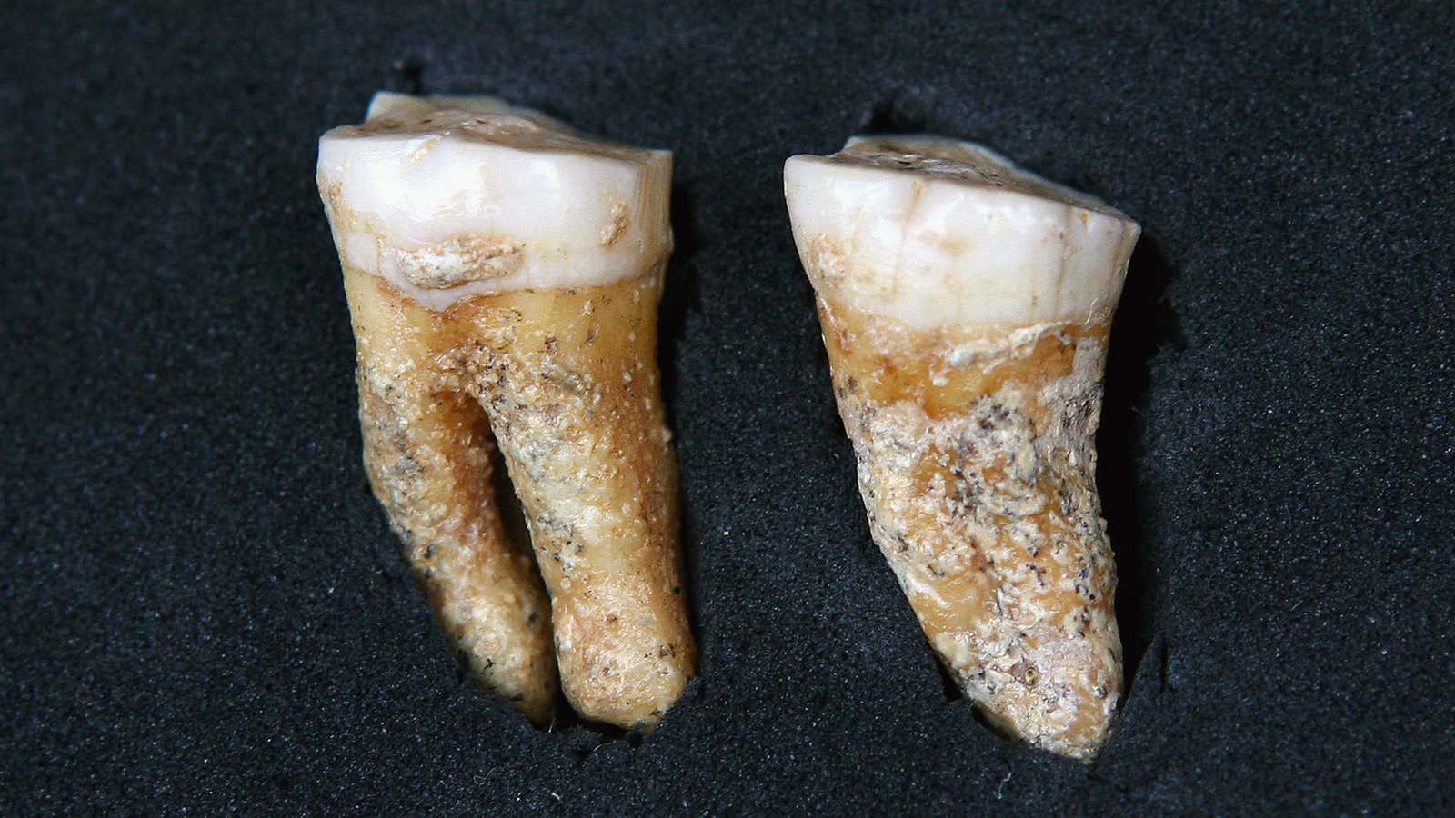 Ancient teeth can be quite telling.