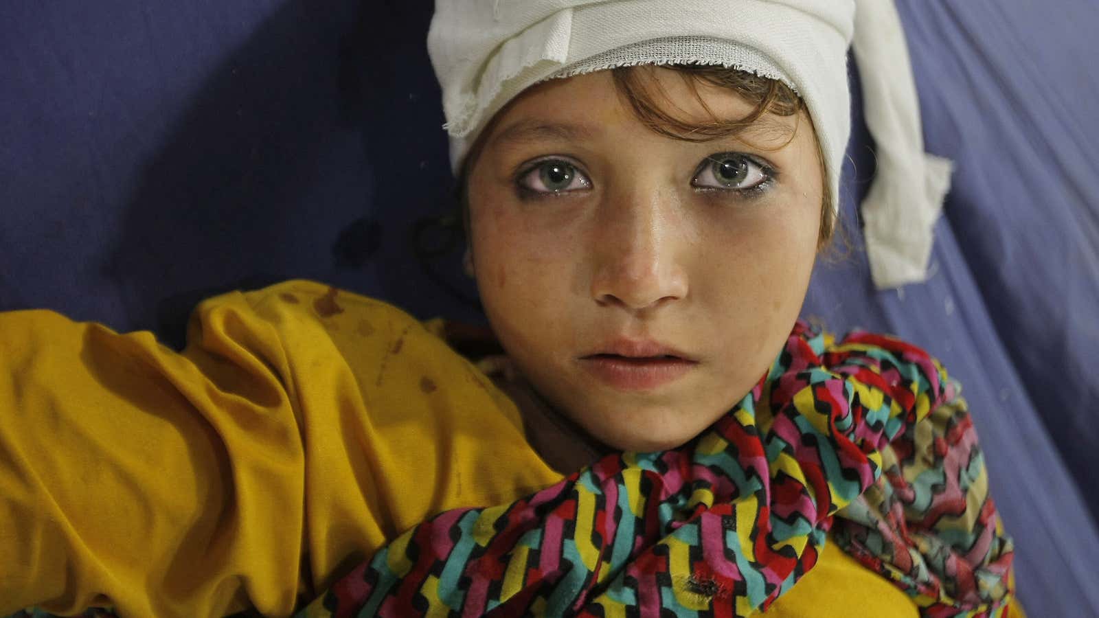 A girl in a hospital in Peshawar, Pakistan.