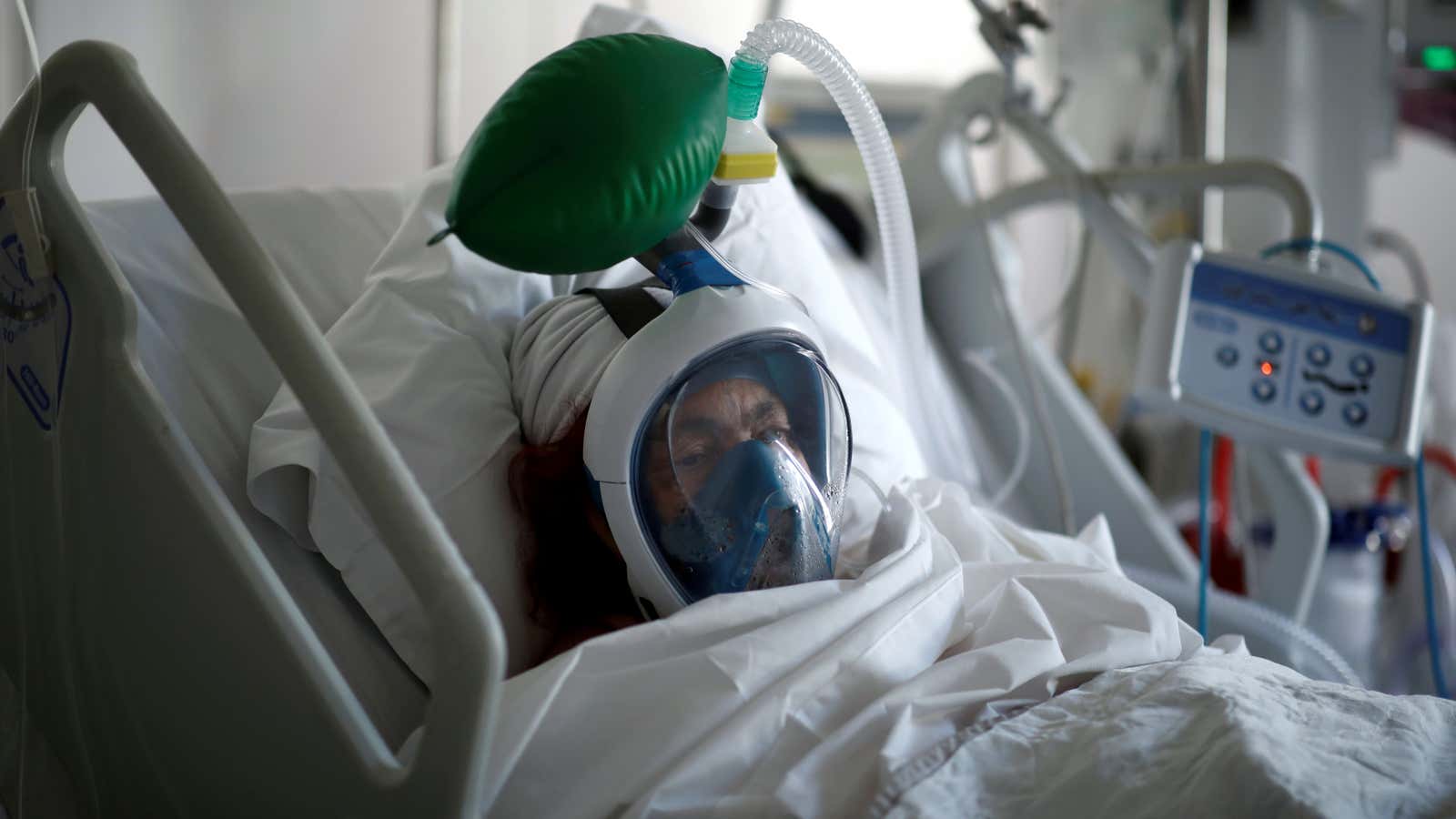 A Covid-19 patient in France wears a non-invasive ventilator made from a scuba mask.