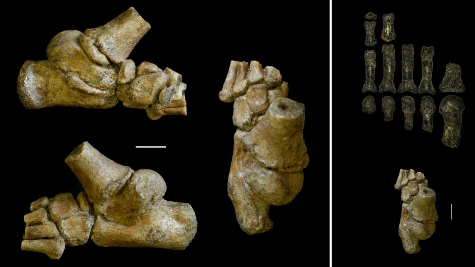 The 3.32 million year old foot of an Australopithecus afarensis toddler shown in different angles.