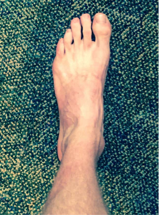 foot picture