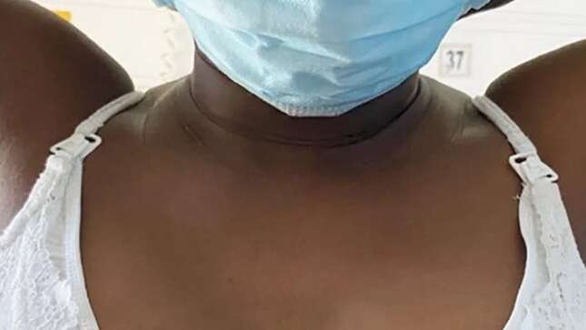 A esta mujer le salió un bulto en la axila tras dar a luz, y entonces comenzó a lactar