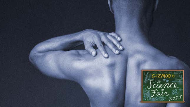 An experimental male birth control gel is applied daily to the shoulders.
