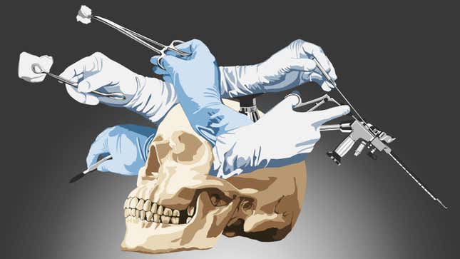 Image for article titled A tumor stole every memory I had. This is what happened when it all came back