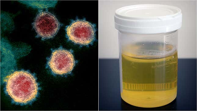 On left, COVID-19 virus; on right, urine sample in plastic specimen cup