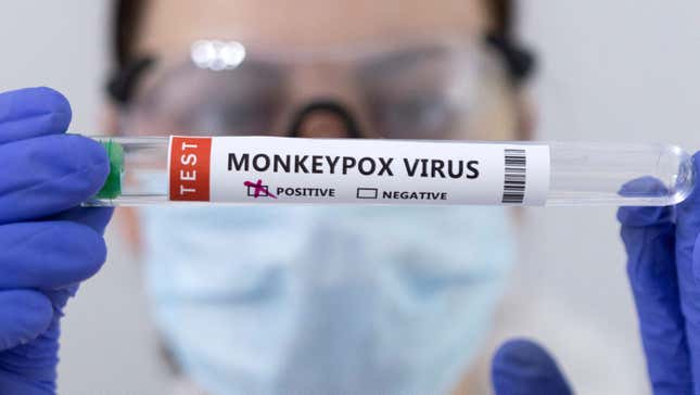 A test tube used to test for the monkeypox virus is held across an examiner's face