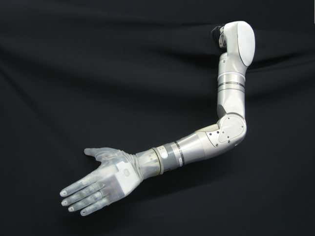 The robot arm is modular, adjustable depending on how much of a limb the patient is missing.
