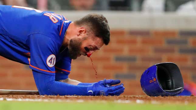 It was a grisly scene yesterday for the Mets’ Kevin Pillar.