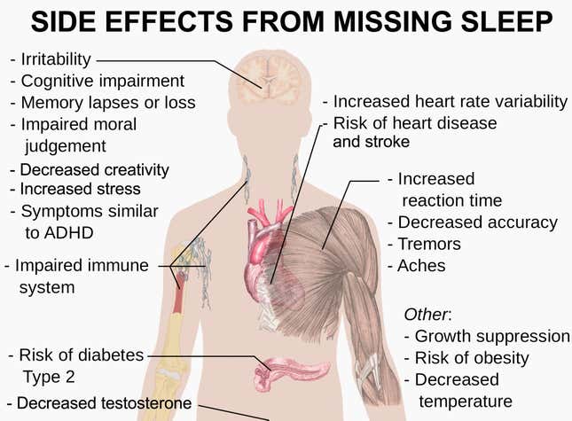 MIssing sleep side effects