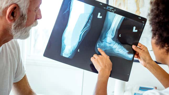Image for article titled Hospital Adds $20,000 Scan That Informs Patient Whether They Have Feet