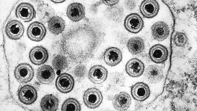 A transmission electron microscopic (TEM) image of many herpes simplex viruses. 