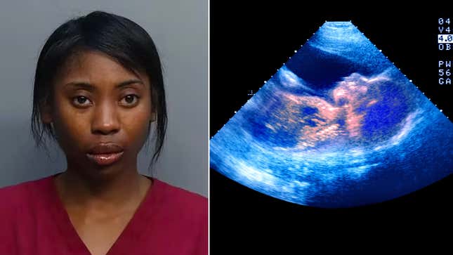 Image for article titled Pregnant Florida Woman Facing Murder Charges Seeks Early Jail Release Because Her &#39;Unborn Child&#39; Is Innocent