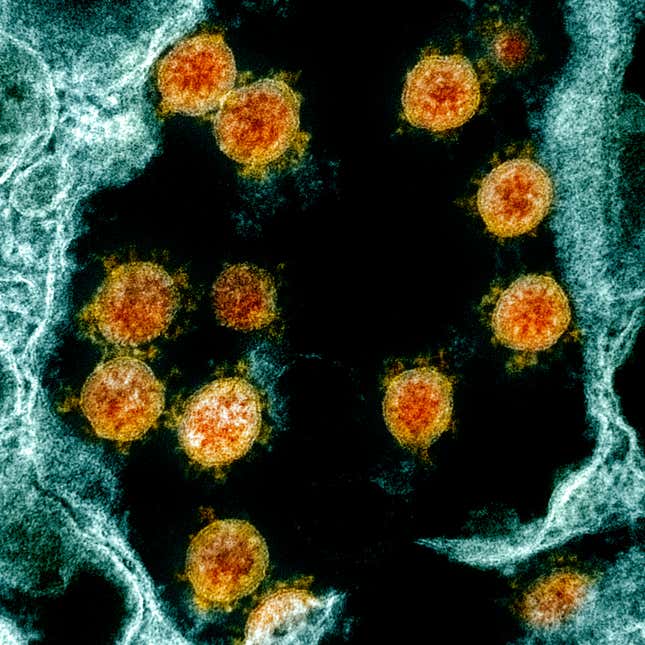Molecular image of coronavirus