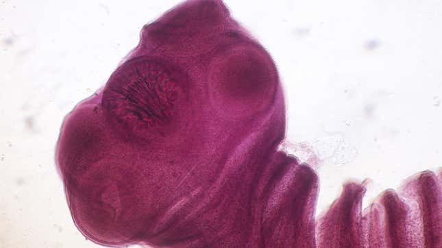 A close-up look at the scolex, or head, of a fully mature pork tapeworm. Interestingly enough, cysticercosis is what happens when the tapeworms don’t get the chance to become adults.