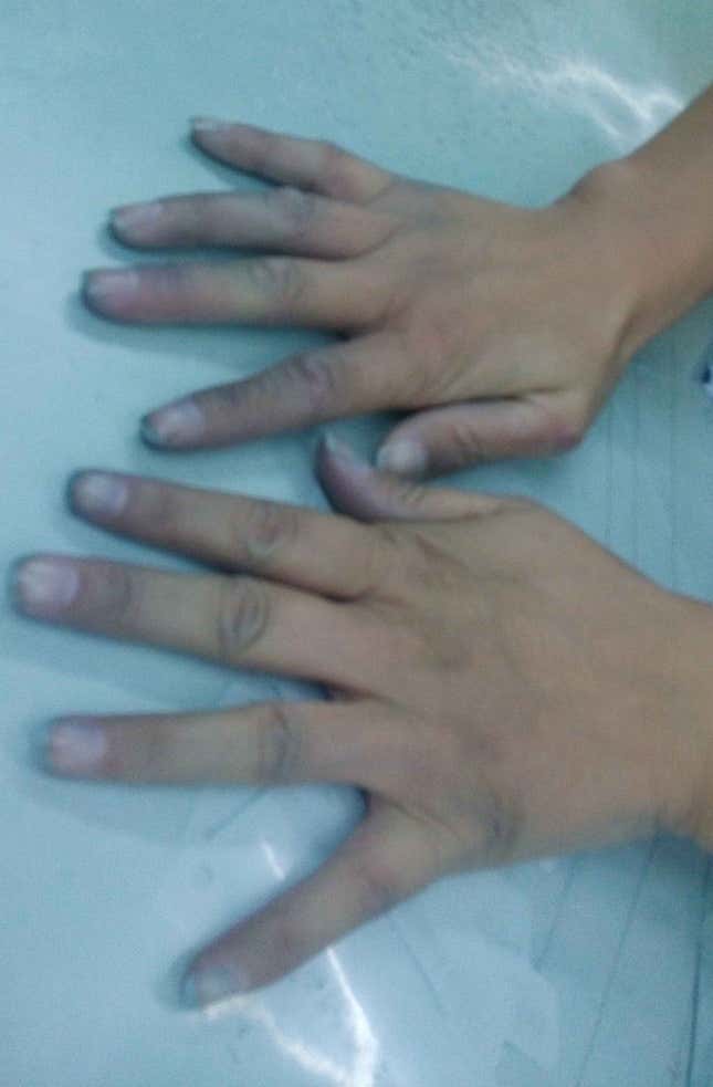 The hands of the workerswho sew denim shirts have turned blue.