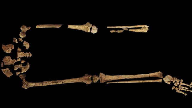 Imagen para el artículo titulado Este esqueleto es la prueba de que los humanos ya amputaban miembros por motivos médicos hace 31000 años