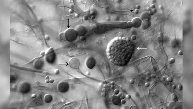 Imagen para el artículo titulado Qué es el “hongo negro” que está afectando gravemente a los pacientes con Covid en India