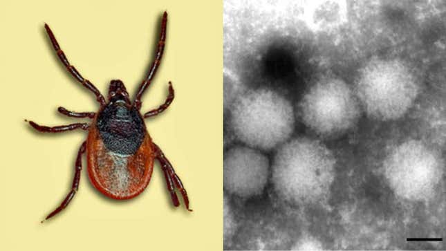 Izquierda: la especie de garrapata, Ixodes persulcatus, que se cree que alberga el virus. Derecha: una imagen de microscopio electrónico del presunto virus Yezo