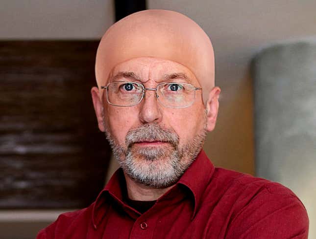 Image for article titled Man Wears Bald Cap To Hide Embarrassing Bald Spot