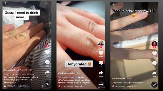 Three TikTok screenshots of people with pinched skin on their knuckle