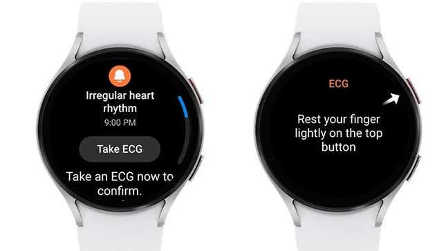 What should show up when the Galaxy Watch detects AFib.