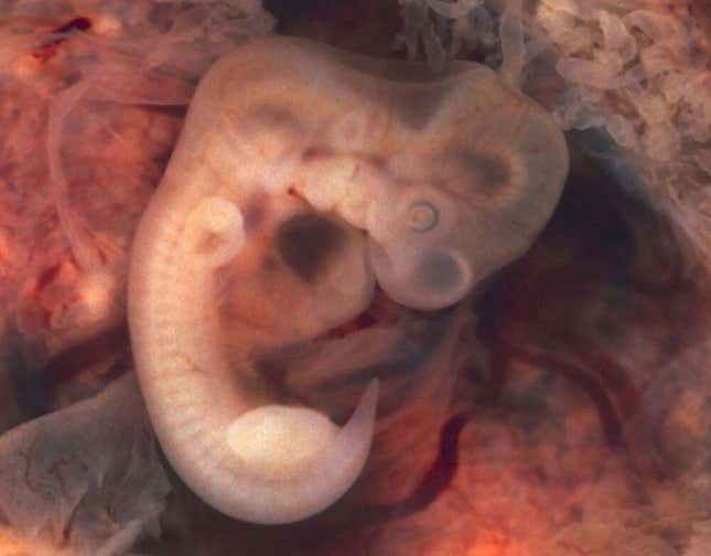 Imagen para el artículo titulado Nace un bebé con una cola humana de 12 centímetros