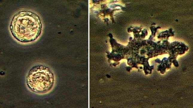 The two main forms of Balamuthia mandrillaris, one of several amoebas that can cause fatal brain infections.
