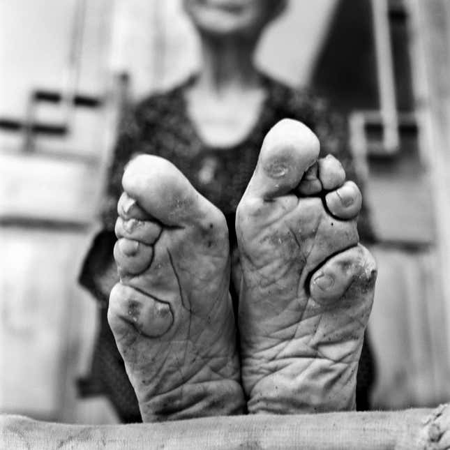 More Than Just Their Feet Powerful Photos Of Chinas Last Female Foot