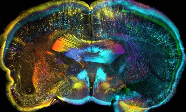 mouse brain
