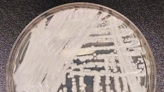 Photo of yeast growing on petri dish