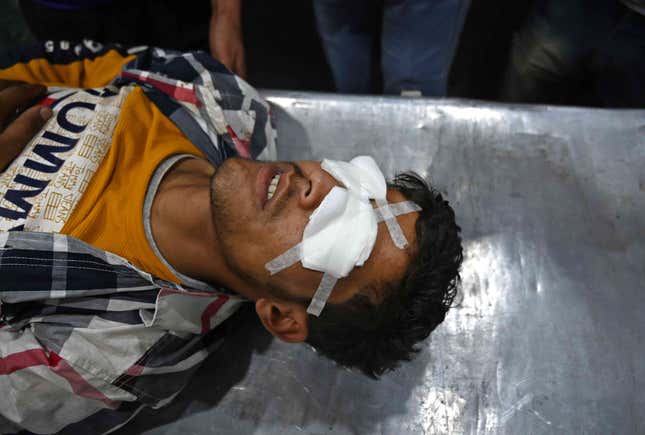 Image for article titled Cut off from hospitals, Kashmiri protesters are treated by amateurs with cycle spokes