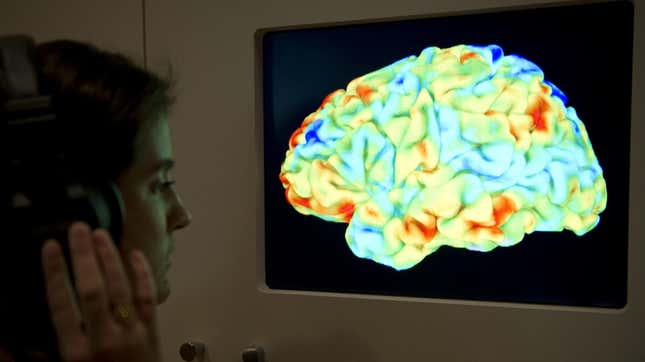A woman looking at a functional magnetic resonance image (fMRI) .