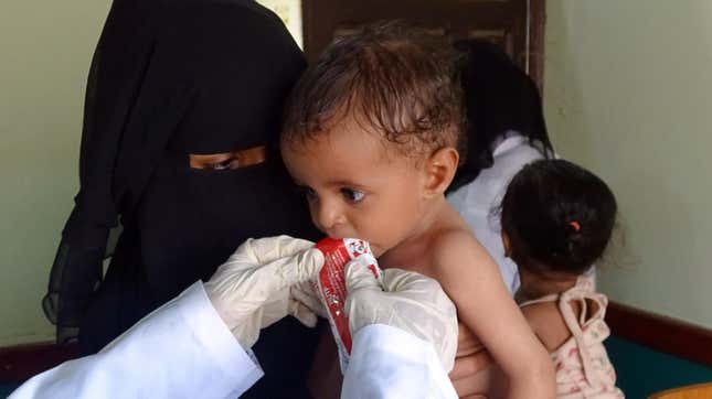 A woman holds a malnourished child at a treatment center in Yemen’s western province of Hodeida, on October 16, 2021. 