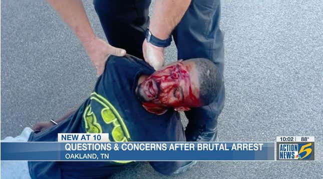 Image for article titled Tennessee Man Beaten by Officers, Speaks Out After Incident [Update]