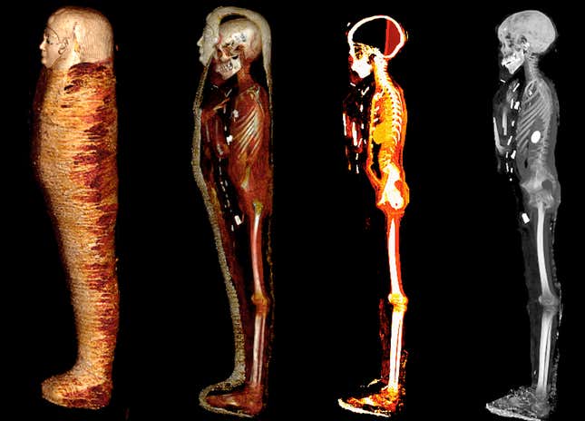 CT scans of the mummy revealed the boy's skeleton and amuluts (white spots on rightmost scan).