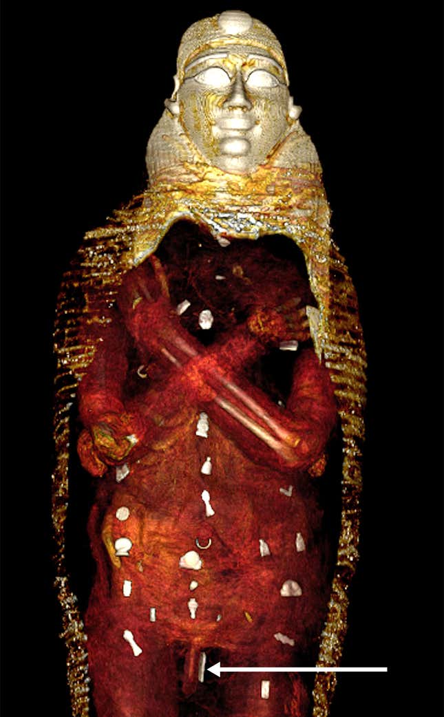 A CT scan reveals the amulets spread across the mummy, with a detail on the amulet on his penis.