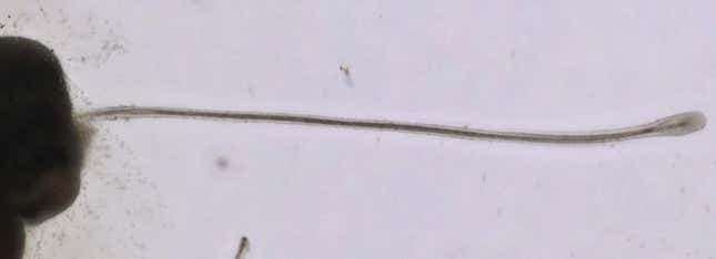 Imagen para el artículo titulado Folículos cultivados en un laboratorio japonés abren una nueva esperanza contra la calvicie