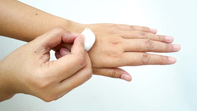 hand rubbing a cotton ball on skin