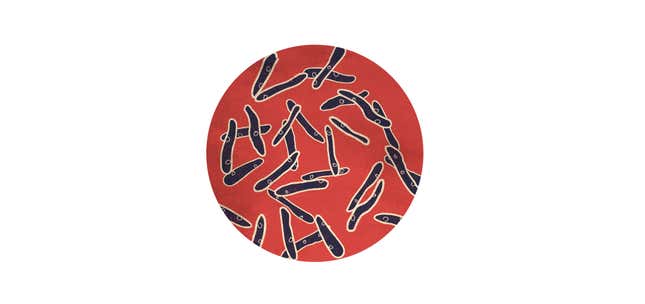 Image for article titled We need more than technology to eliminate tuberculosis