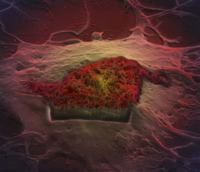 brain astrocyte
